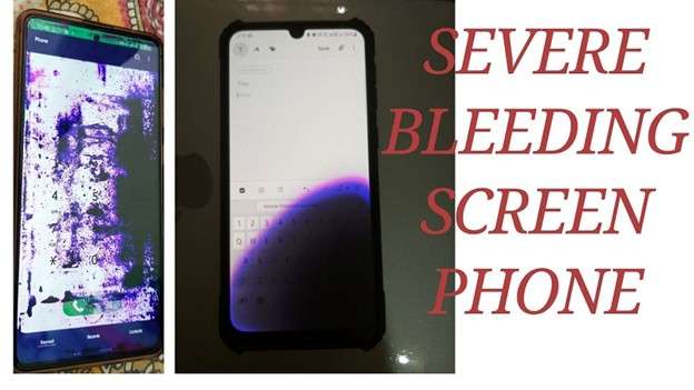 severe bleeding display phone