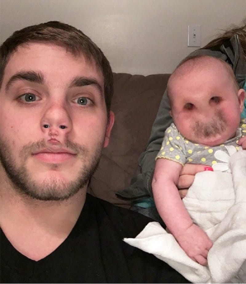 nose and baby face swap