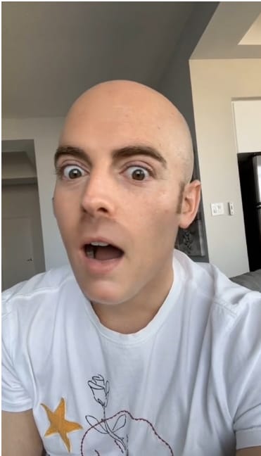 Surprising Result of TikTok No Beard Filter