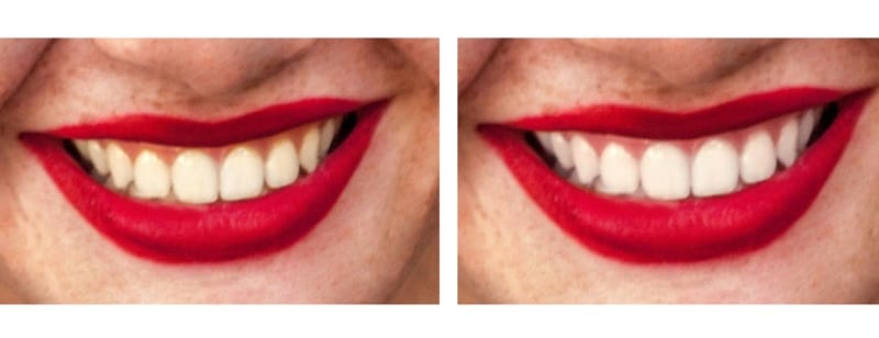 whiten your teeth with photoshop face editor