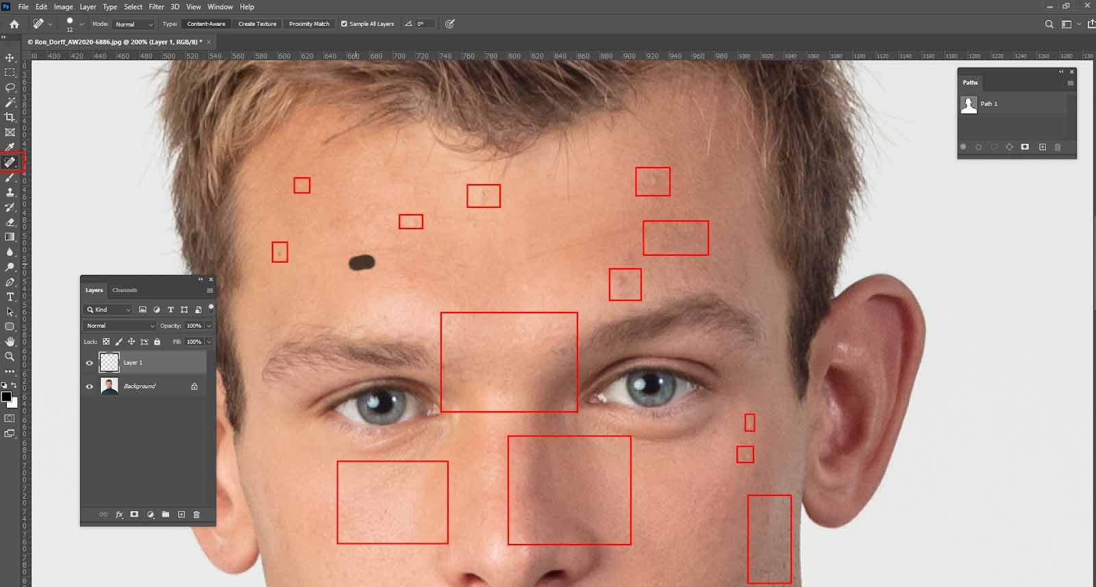 Outil de brossage cicatrisant pour l'élimination des taches