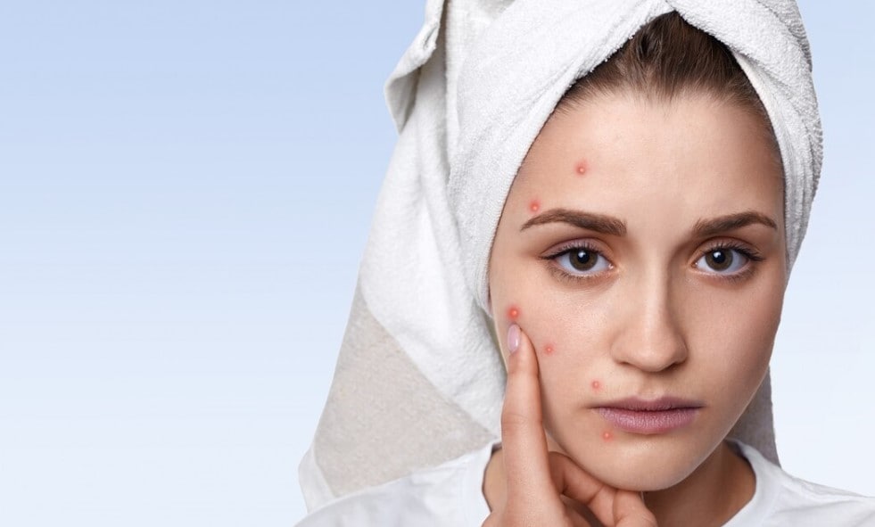 photo of woman with spots