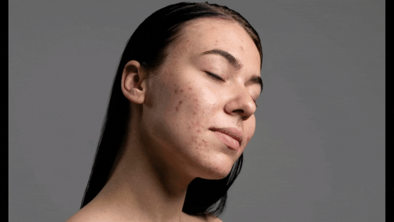 photo of woman with spots