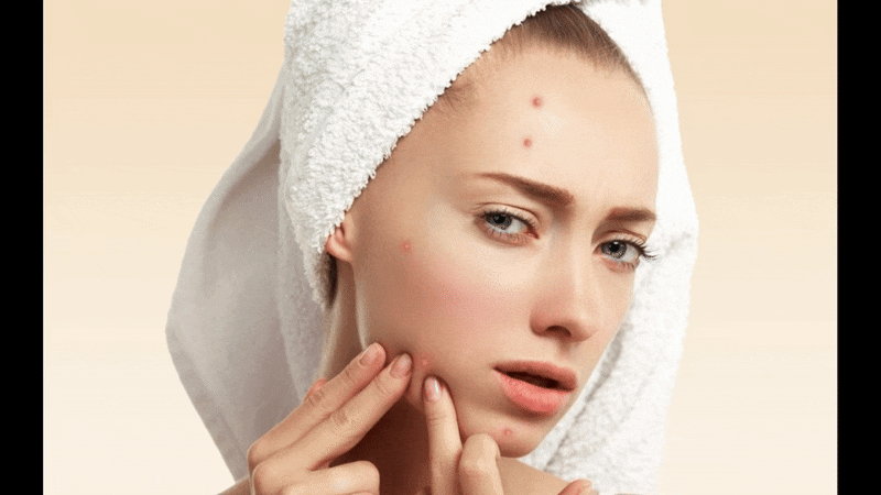photo of woman with spots