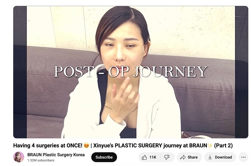 before and after vlog
