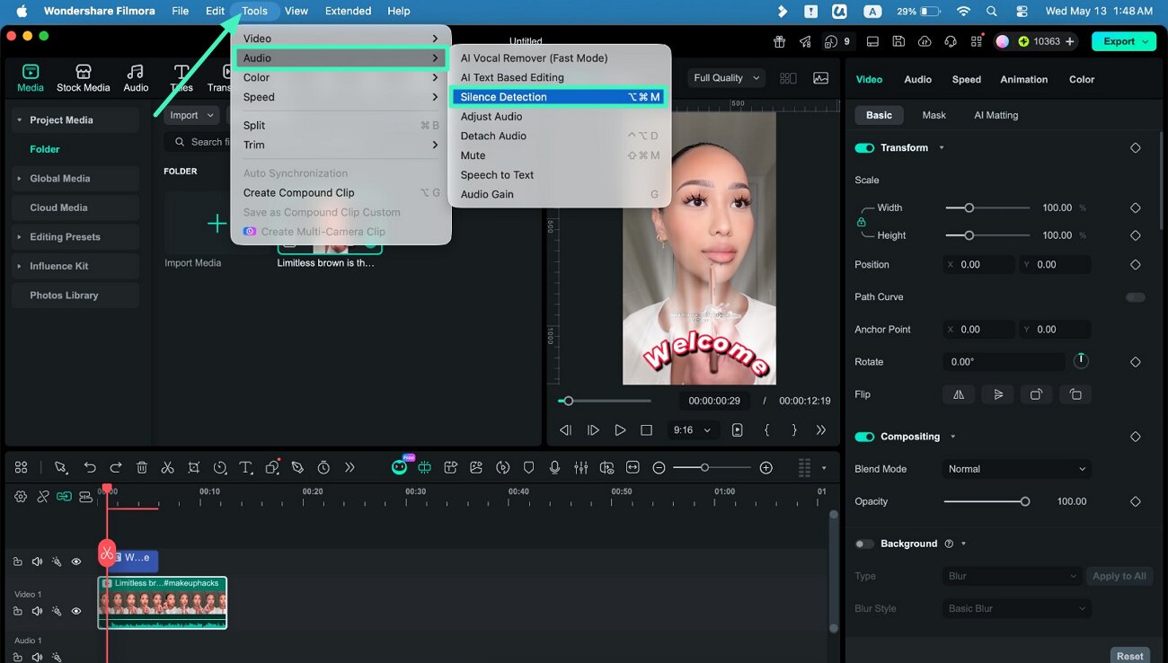 access silence detection feature