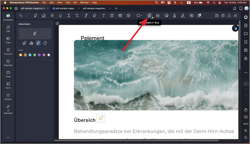 add attachment to document