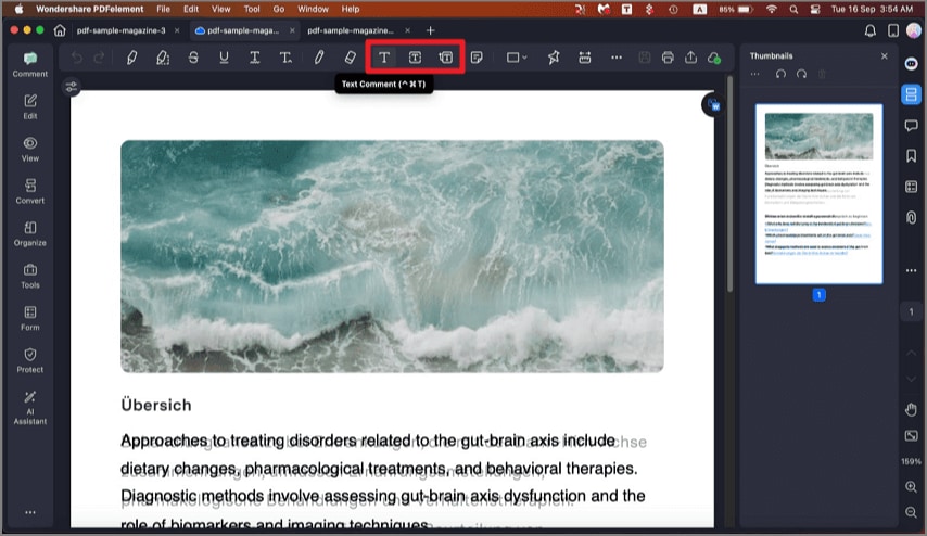 select comment type
