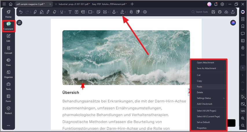 add attachment to document
