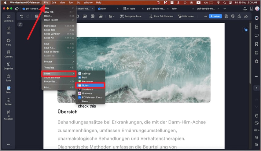 share notes