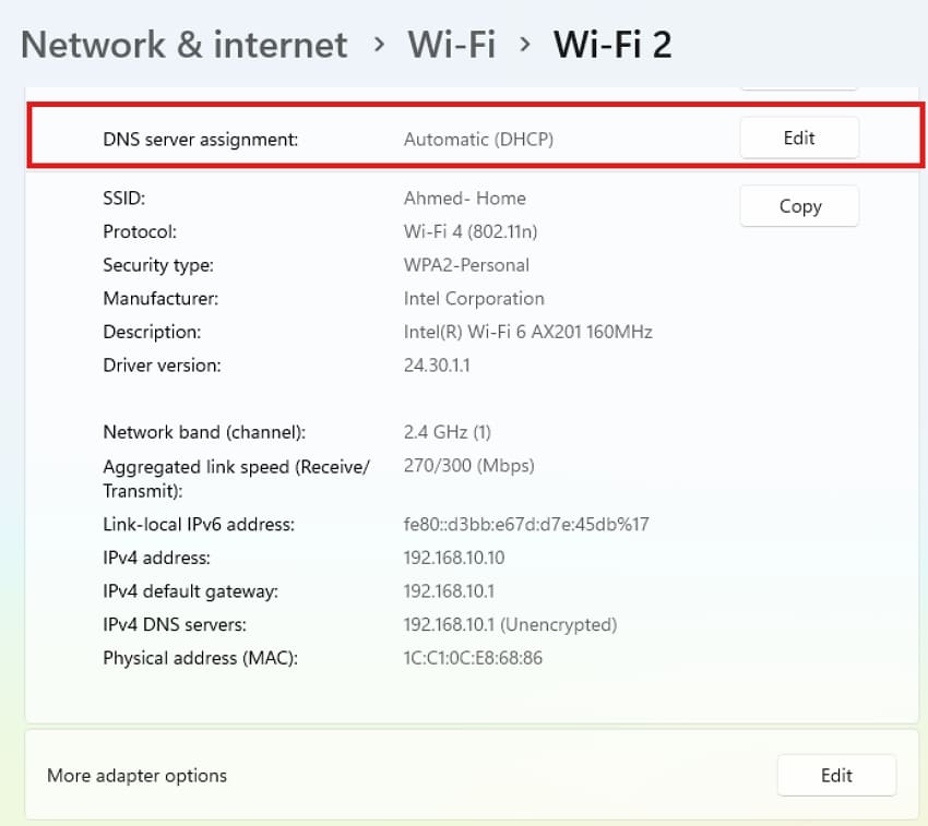 edit dns server assignment