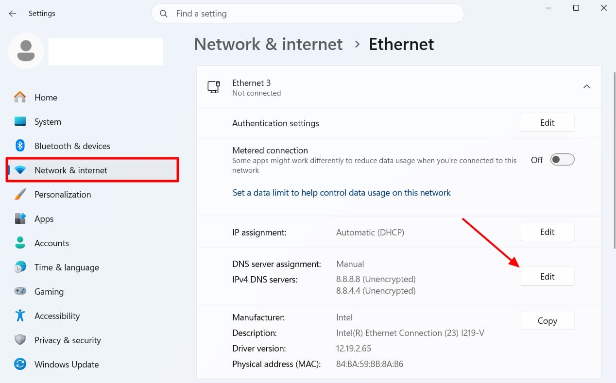 access dns assignment settings