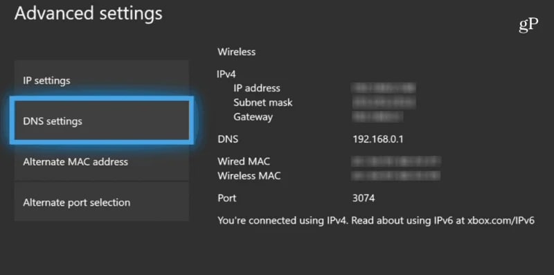 change dns settings