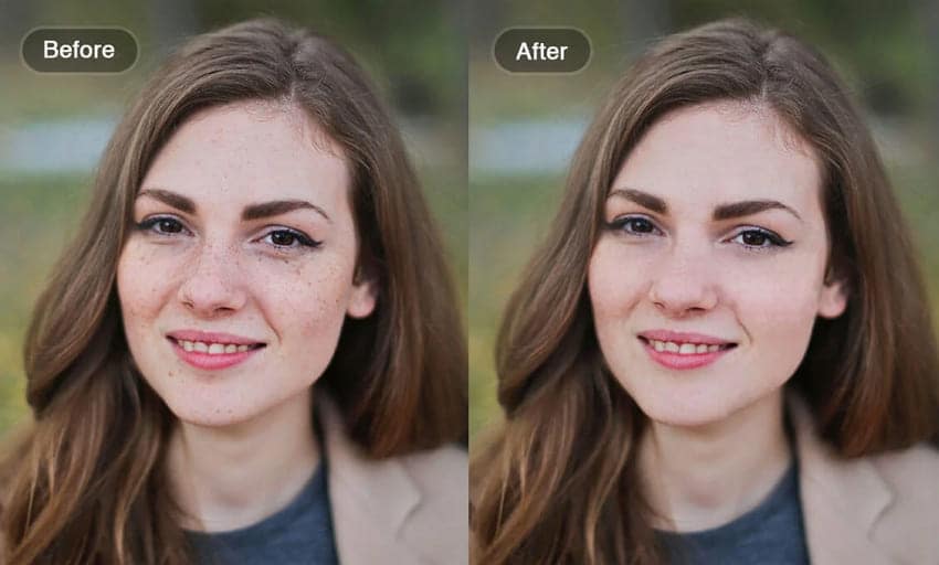 why remove blemishes
