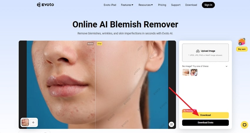 download image without blemishes