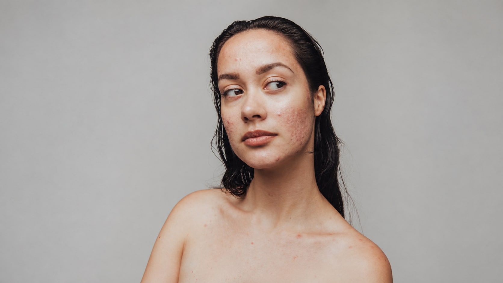 remove pimple online before