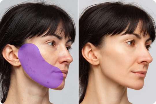 remove blemishes from photo with ai precision