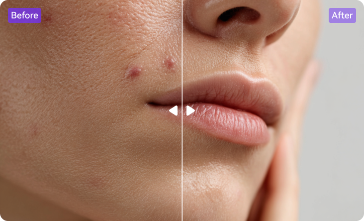 remove pimples from photo