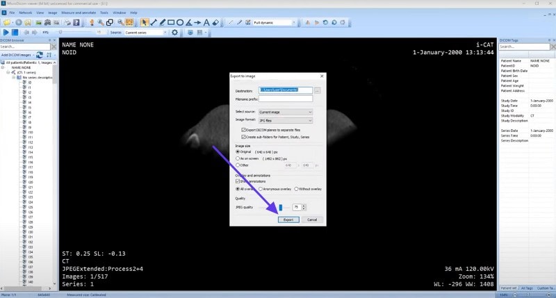 change format microdicom