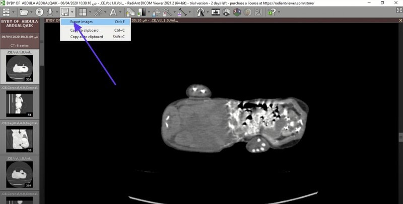 radiant dicom viewer to convert format