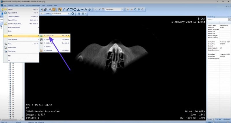 add pictures to dicom converter