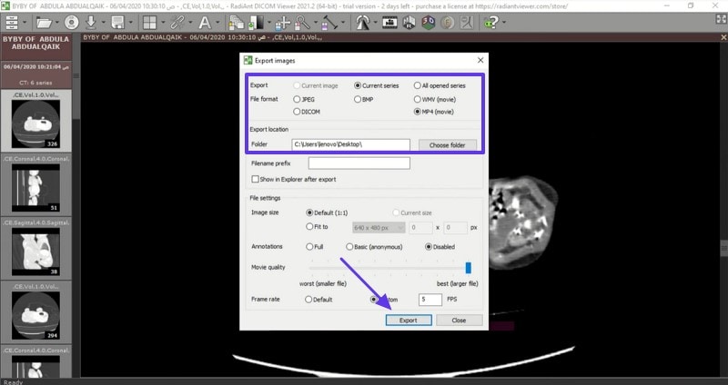 use radiant dicom converter