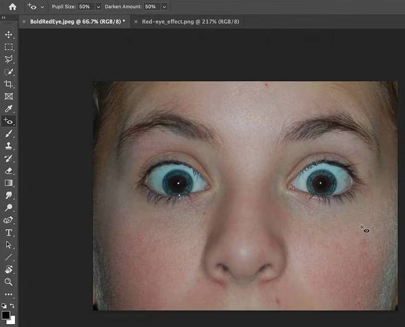  click on the affected eyes again