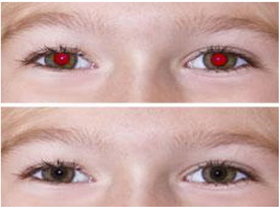  What Causes Red Eyes 